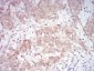 MAP2K3 Antibody
